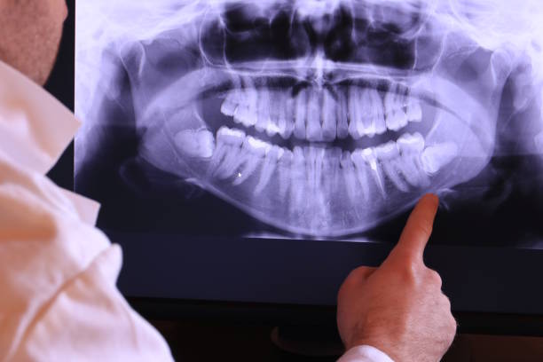 Best Emergency Denture Repair in Jacksonville, FL